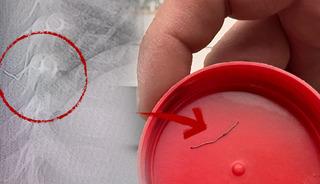 1 yaşındaki bebeğin sırtından 2 santimlik metal tel &ccedil;ıktı! 