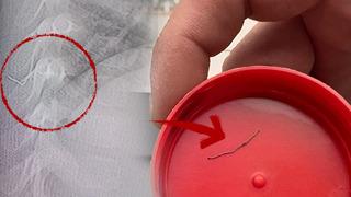 1 yaşındaki bebeğin sırtından 2 santimlik metal tel çıktı! 