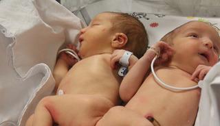 Depremde &ouml;ks&uuml;z ve yetim kalan siyam ikizlerini &ouml;l&uuml;m ayırdı