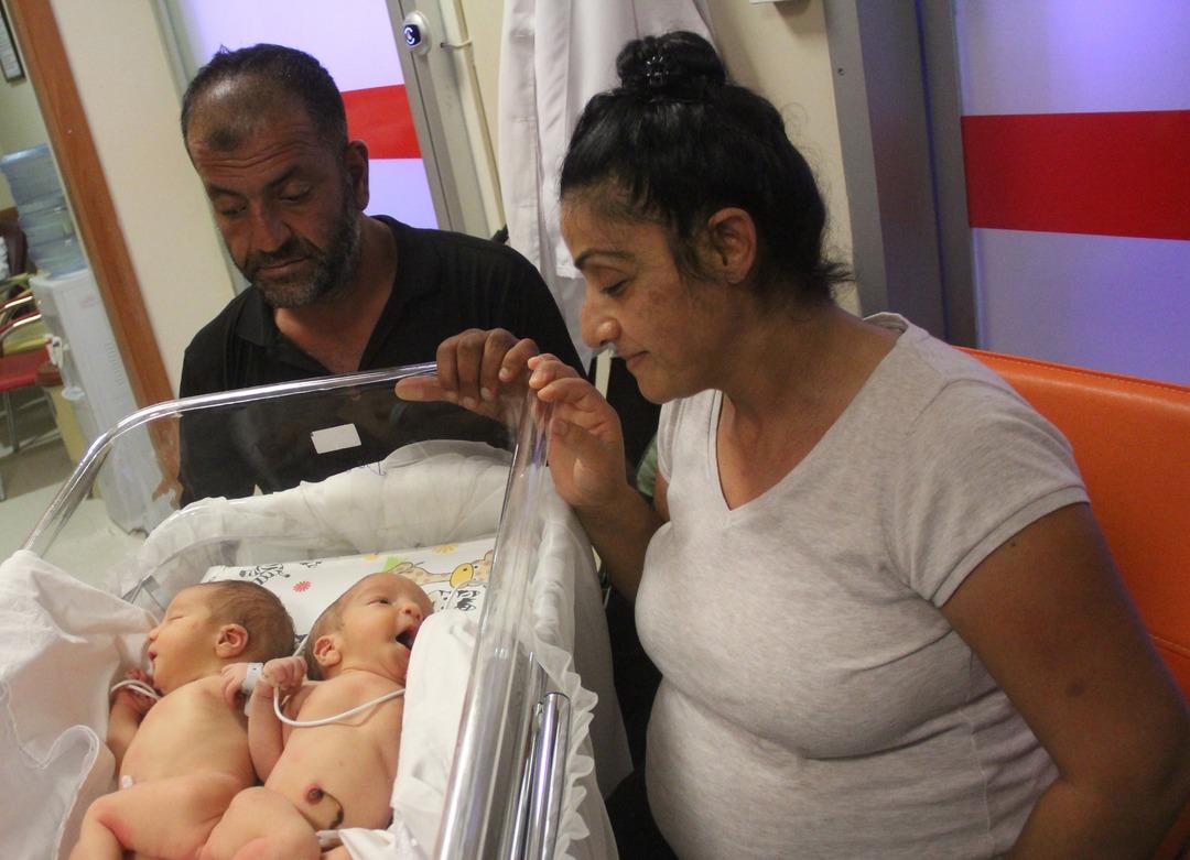 Depremde &ouml;ks&uuml;z ve yetim kalmışlardı: Siyam ikizlerini 9 yaşında &ouml;l&uuml;m ayırdı! 3