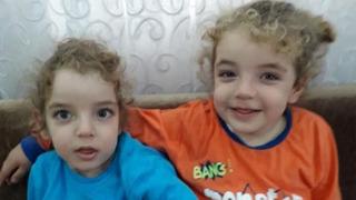 Depremde öksüz ve yetim kalmışlardı: Siyam ikizlerini 9 yaşında ölüm ayırdı!