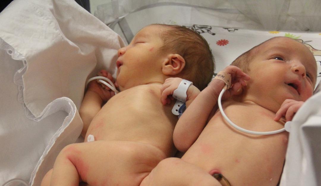 Depremde &ouml;ks&uuml;z ve yetim kalmışlardı: Siyam ikizlerini 9 yaşında &ouml;l&uuml;m ayırdı! 1