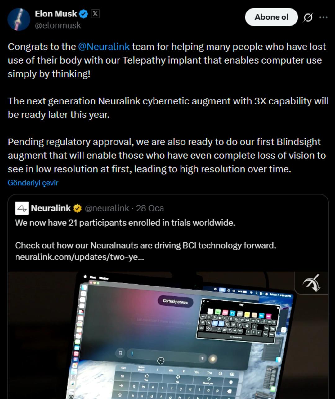 Elon Musk duyurdu! Doğuştan g&ouml;rme engellilere bile ışık olacak 1