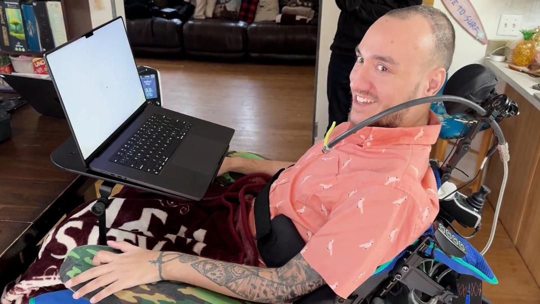 Elon Musk duyurdu! Doğuştan g&ouml;rme engellilere bile ışık olacak 4