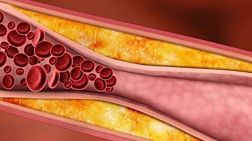 Kolestrl yüksekliğine dikkat! 