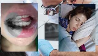 Kanal tedavisi hayatını kabusa &ccedil;evirdi! "İki yıl ağzımda paslı demirle yaşamışım"