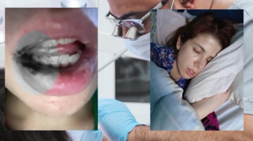 Kanal tedavisi hayatını kabusa &ccedil;evirdi! "İki yıl ağzımda paslı demirle yaşamışım"