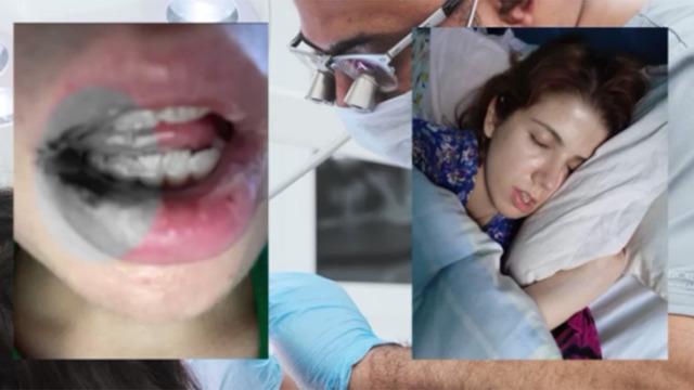 Kanal tedavisi hayatını kabusa çevirdi! İki yıl ağzımda paslı demirle yaşamışım