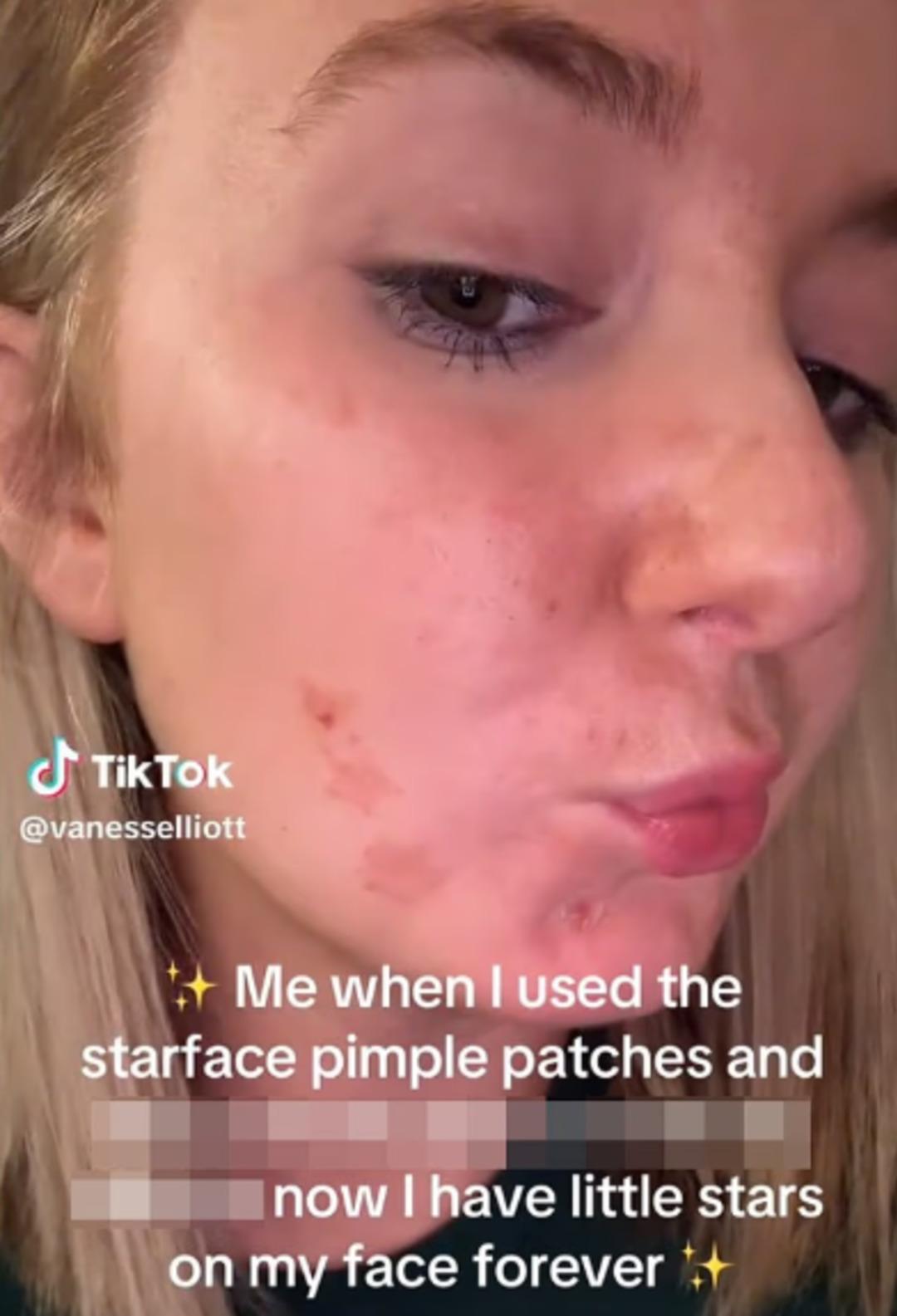 D&uuml;nyaca &uuml;nl&uuml; isimler bile tanıtımını yaptı: Kullananın y&uuml;z&uuml; mahvoldu! 1