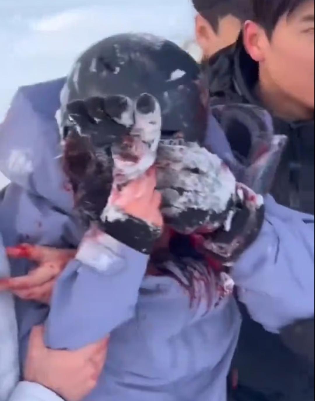 Az kalsın son sefiesi olacaktı: Kanlar içinde kaldı! Sosyal medyada gündem oldu 1