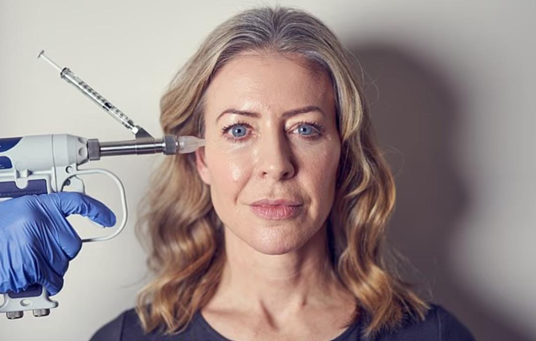 20 yıl boyunca suratının altında kalmış! Erimesini beklediği dolgular şişip t&uuml;m y&uuml;z&uuml;n&uuml; kaplamış 3