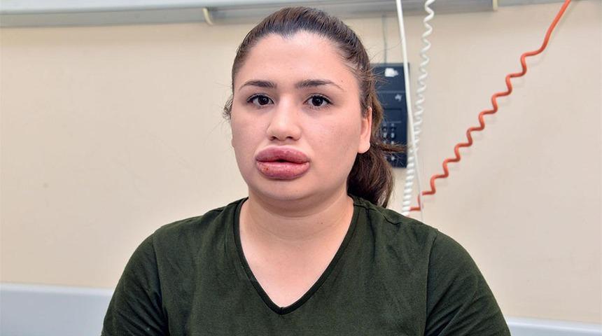 Türkiye onu dudaklarıyla tanımıştı! İşte son hali