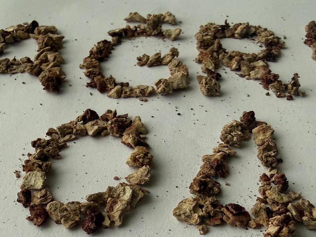 21 kez operasyon ge&ccedil;irdi: B&ouml;breğinden 295 taş &ccedil;ıkarıldı!