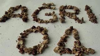 Daha önce 21 kez operasyon geçirdi: Böbreğinden 295 taş çıkarıldı!