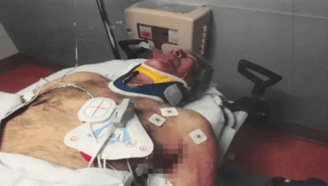 Epstein &ouml;lmedi mi? O iddia intihardan hemen sonraki fotoğraflarla yanıt buldu! 3