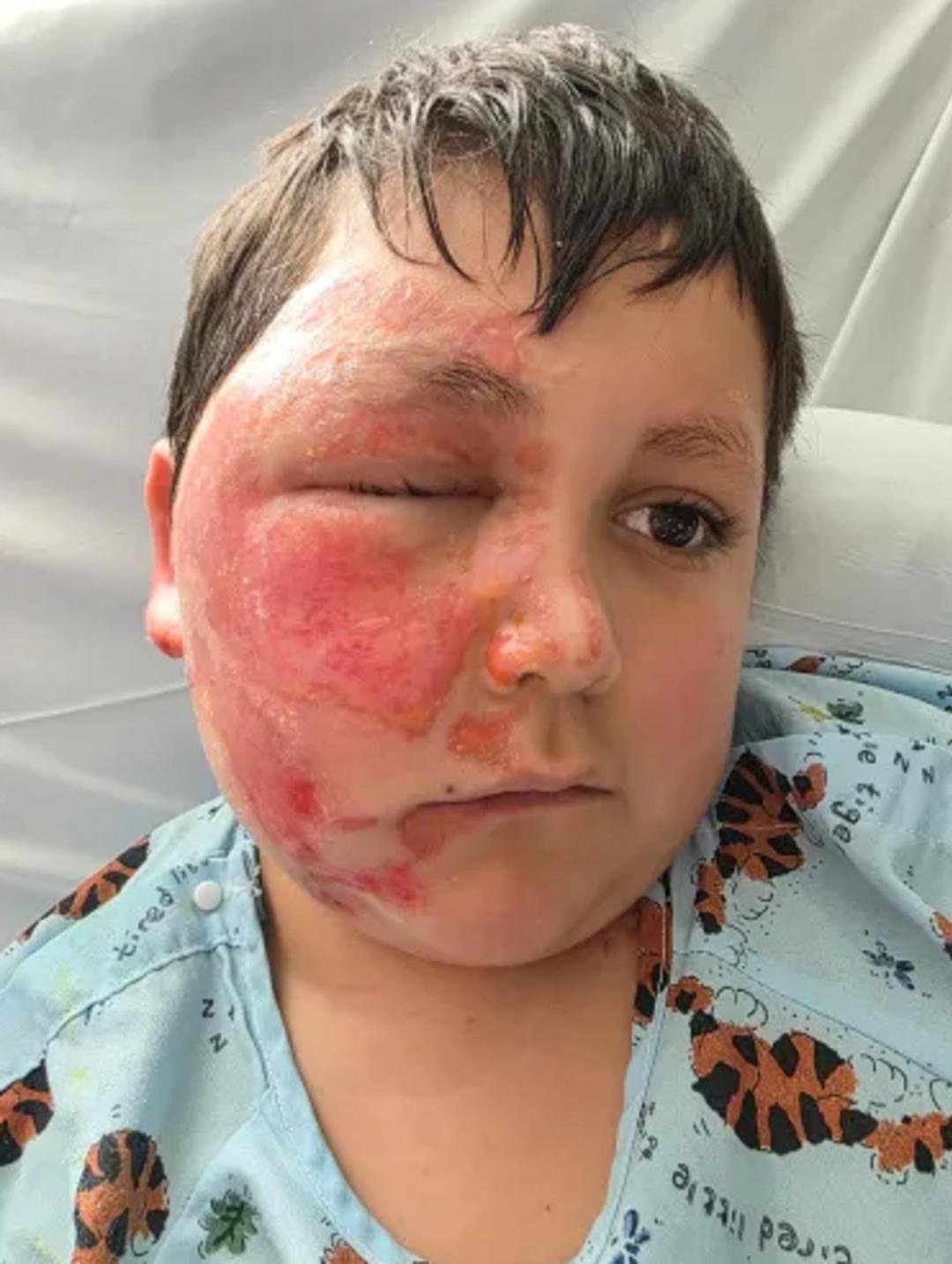 Sosyal medyada g&ouml;r&uuml;p denedi, t&uuml;m y&uuml;z&uuml; yandı! O oyuncak kabusu yaşattı 2