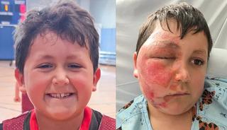 Sosyal medyada g&ouml;r&uuml;p denedi, t&uuml;m y&uuml;z&uuml; yandı!