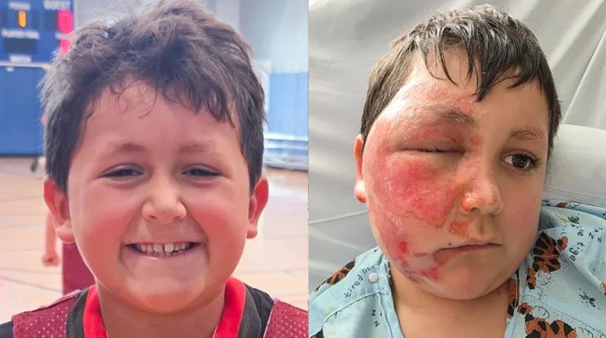 Sosyal medyada g&ouml;r&uuml;p denedi, t&uuml;m y&uuml;z&uuml; yandı! O oyuncak kabusu yaşattı