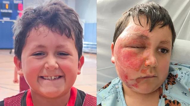 Sosyal medyada görüp denedi, tüm yüzü yandı! O oyuncak kabusu yaşattı