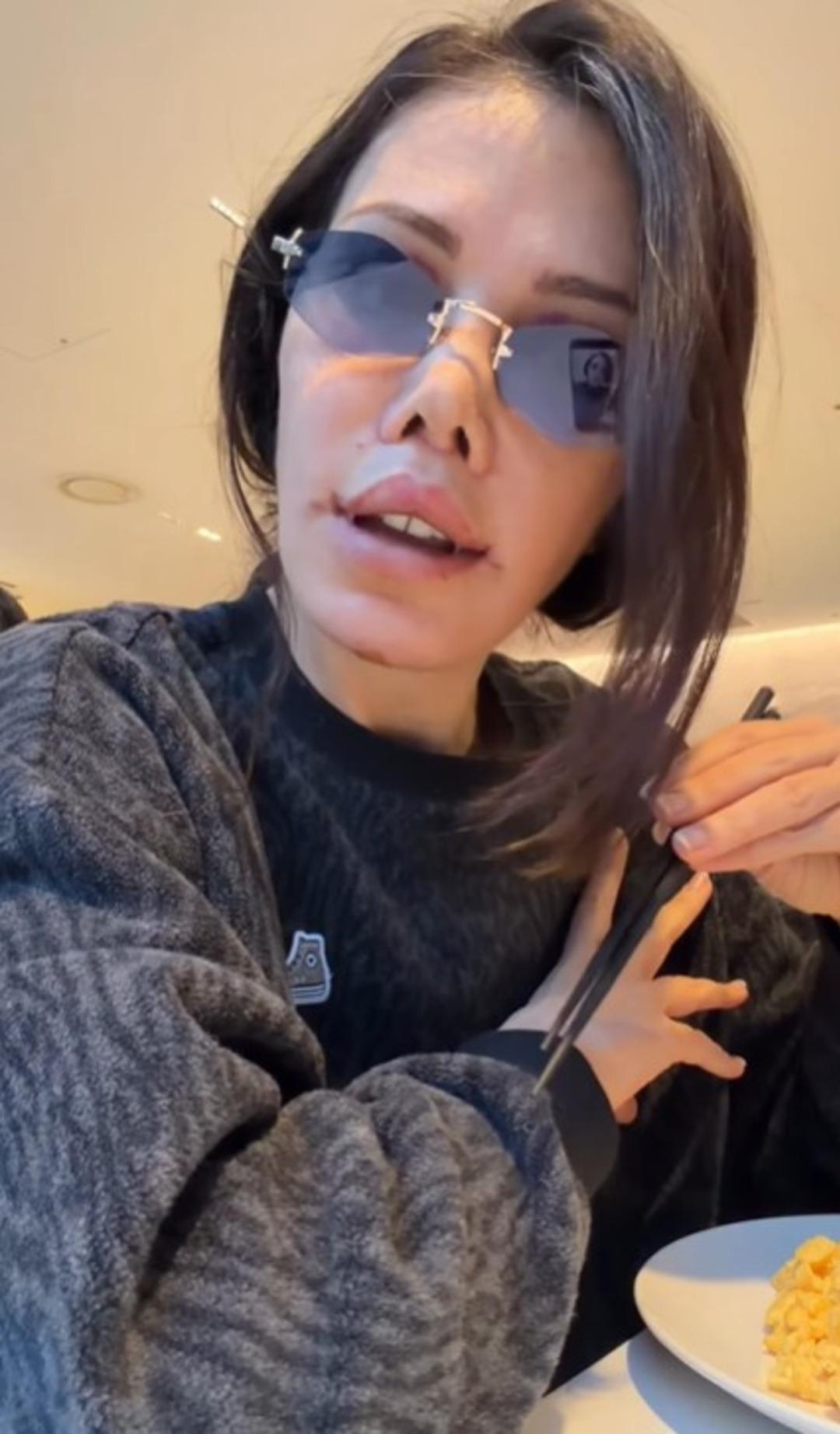 Eski Survivor yarışmacısı Didem Ceran y&uuml;z nakli yaptırdı! Operasyon tam iki g&uuml;n s&uuml;rd&uuml;   6