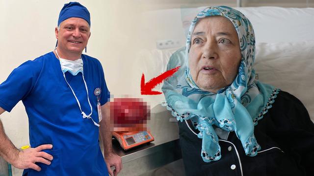 Kilo aldı sandı, karnından çıkana doktor bile şaşırdı! Meslek hayatımda ilk