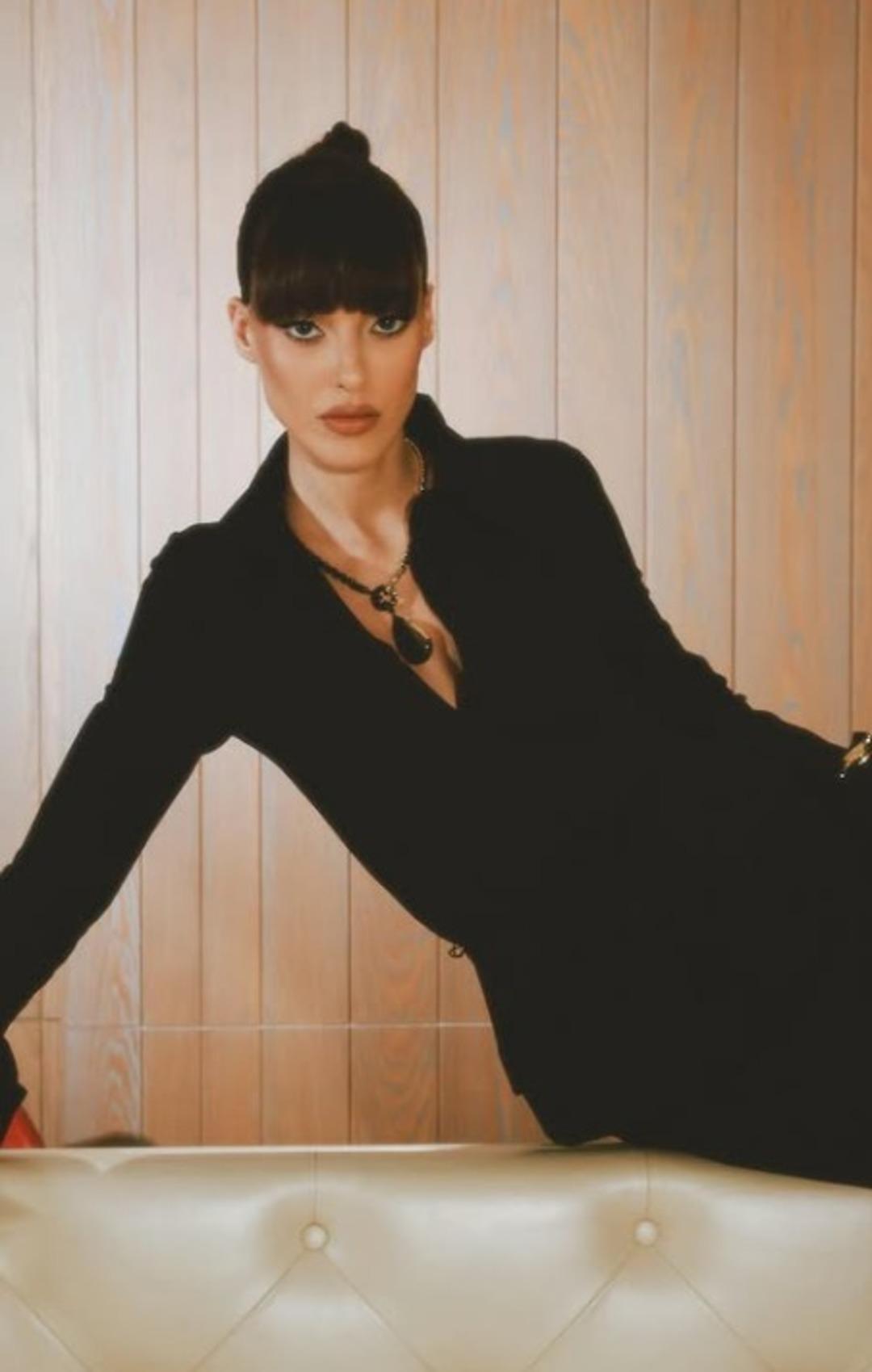 Dilan &Ccedil;i&ccedil;ek Deniz in y&uuml;z&uuml;ndeki değişim dikkat &ccedil;ekti! Son haline yorum yağdı 2