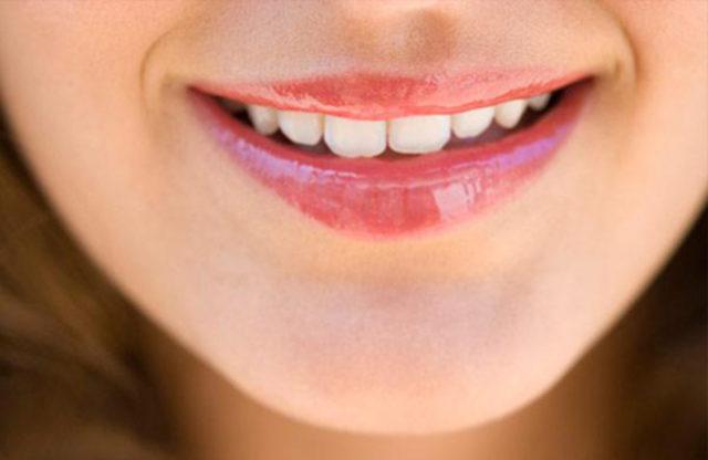 Dudakları estetiksiz dolgunlaştırmanın 5 yolu 4