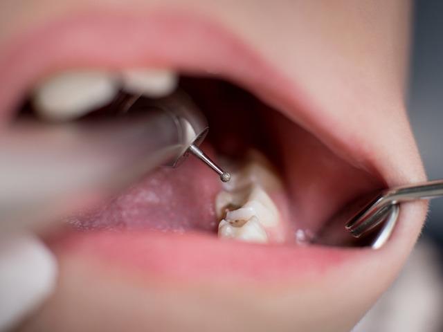 Dişlerinize i&ccedil;ten i&ccedil;e zarar veriyor! İşte 3 tehlikeli belirti