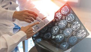 Demansın en sinsi belirtisi &ouml;ğlen ortaya &ccedil;ıkıyor!