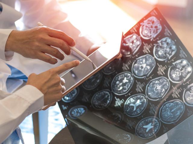 Demansın en sinsi belirtisi &ouml;ğlen ortaya &ccedil;ıkıyor!