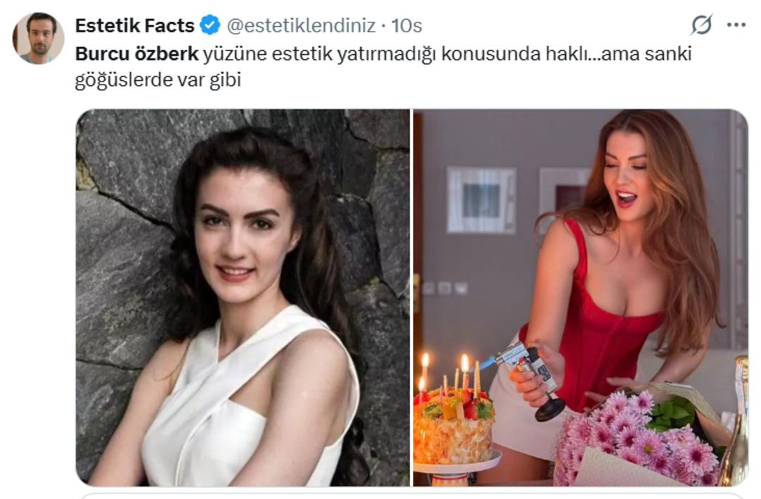 Burcu Özberk: "Benim hiç estetiğim yok" 1
