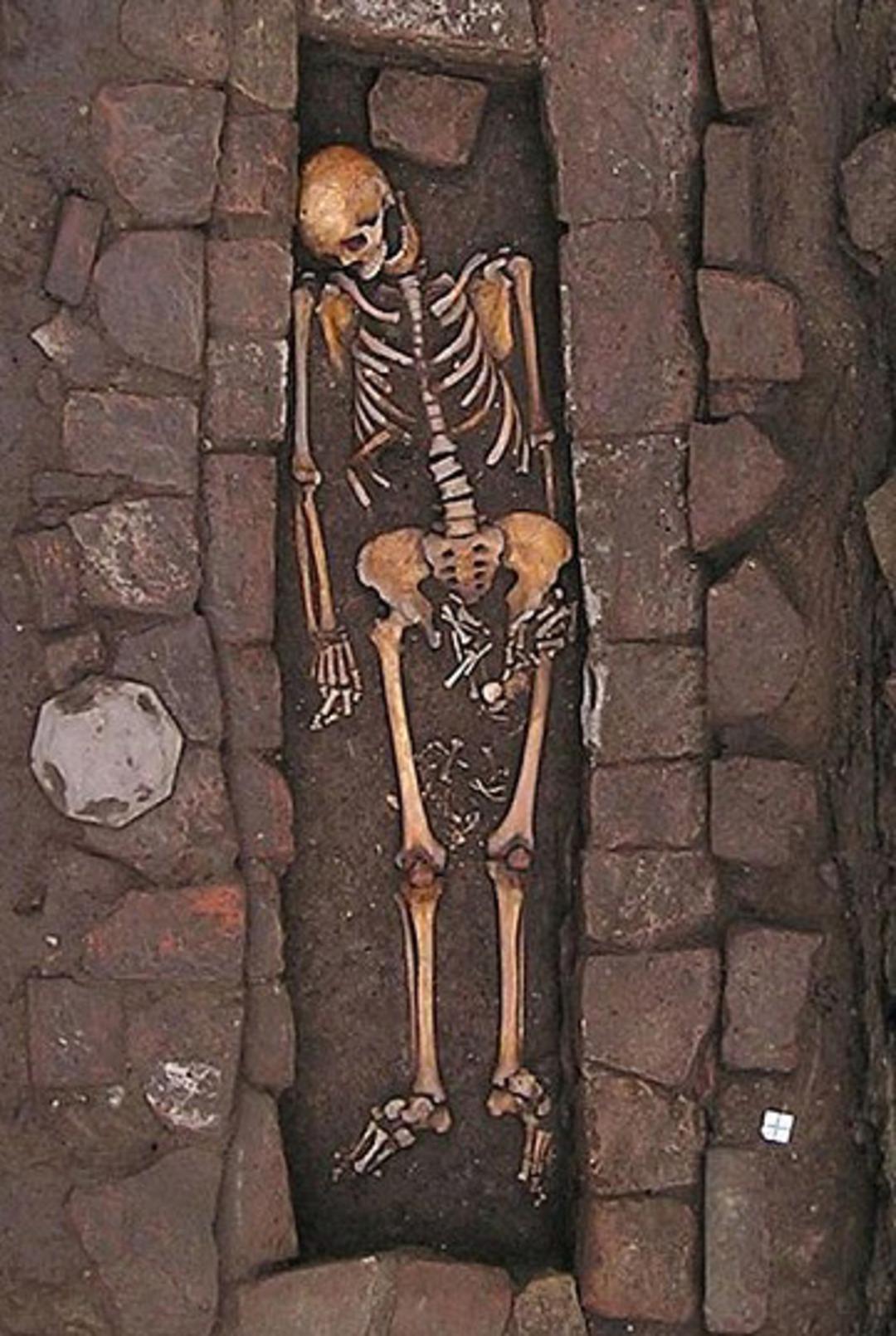 G&ouml;m&uuml;ld&uuml;kten sonra doğum yapmış!