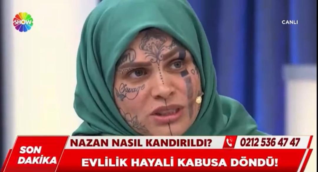 Dolandırıldığı iddiasıyla g&uuml;ndeme gelmişti: Y&uuml;z&uuml;ndeki d&ouml;vmelerle dikkat &ccedil;ekti! 1