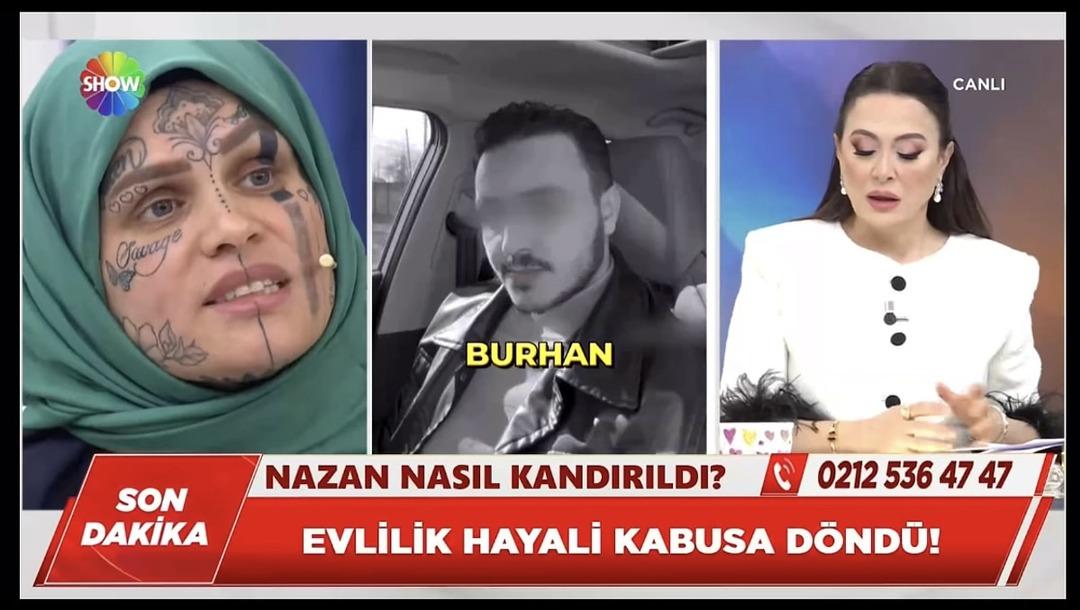 Dolandırıldığı iddiasıyla g&uuml;ndeme gelmişti: Y&uuml;z&uuml;ndeki d&ouml;vmelerle dikkat &ccedil;ekti! 2