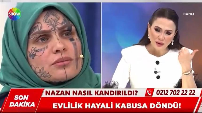 Dolandırıldığı iddiasıyla g&uuml;ndeme gelmişti: Y&uuml;z&uuml;ndeki d&ouml;vmelerle dikkat &ccedil;ekti!