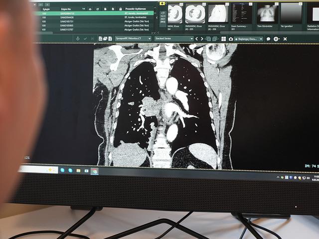 'Rekor seviye' Son 10 yılda y&uuml;zde 38 arttı! 