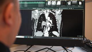 'Rekor seviye' Profesörden korkutan uyarı: Son 10 yılda yüzde 38 arttı! 