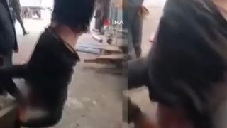 Bu nasıl vicdansızlık! Zihinsel engelli genci ayağından bağlayıp vince astılar
