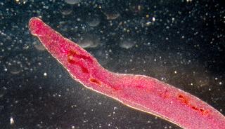 K&uuml;resel salgın: Cinsel organlara yerleşen parazit yayılabilir!