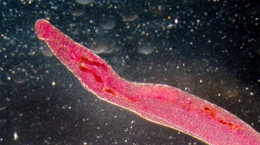 K&uuml;resel salgın tehdidi: Cinsel organlara yerleşen parazit yayılabilir!