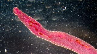 Küresel salgın tehdidi: Cinsel organlara yerleşen parazit yayılabilir!