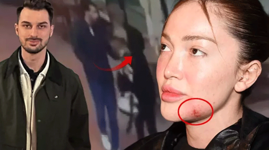 Danla Bilic'i darp eden eski sevgili Berk &Ccedil;etin'e hapis cezası