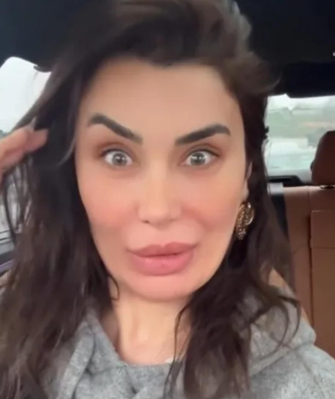 Ebru Şancı botoksu abarttı! Bir kaşı havada kaldı 1