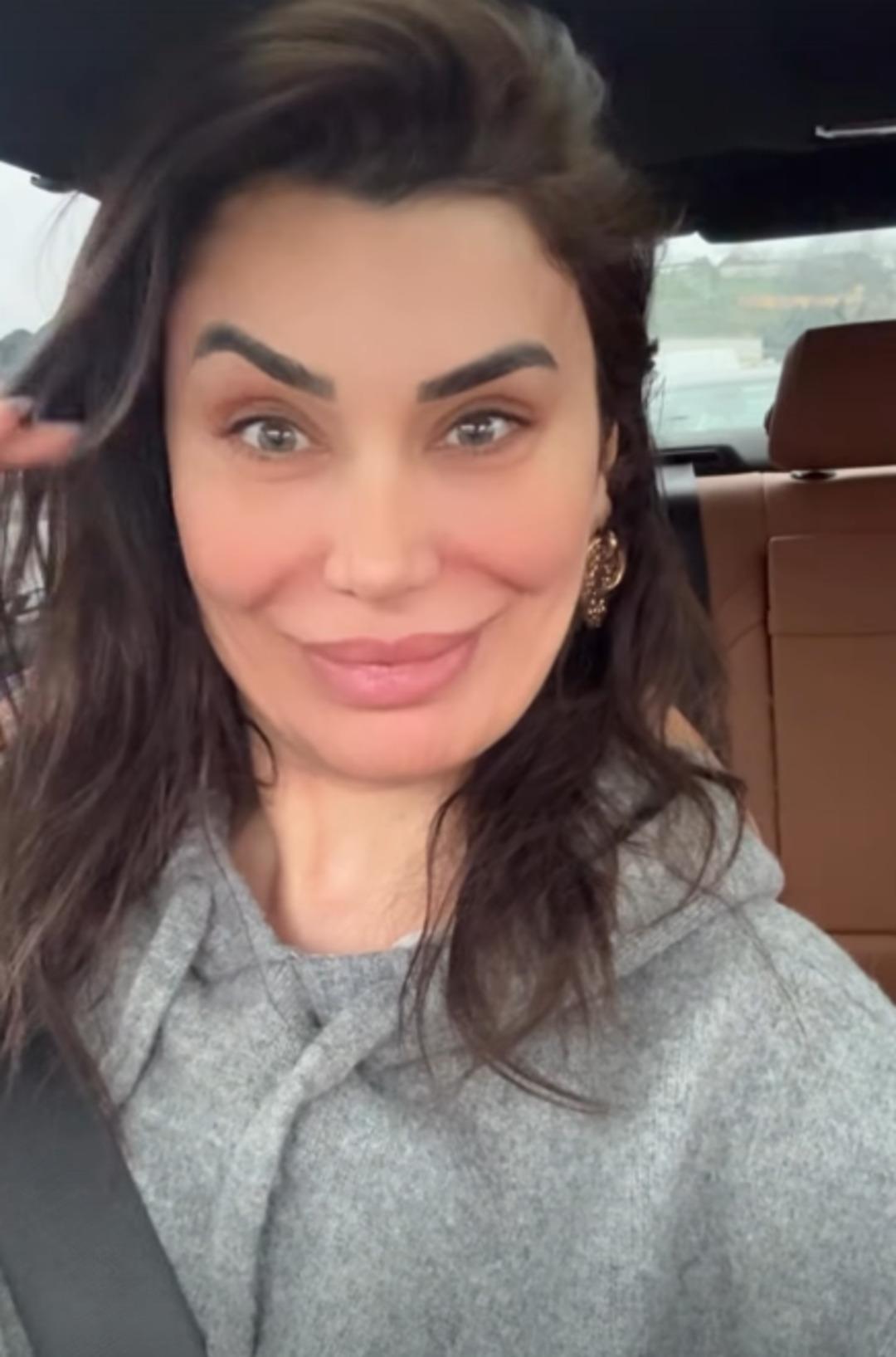 Ebru Şancı botoksu abarttı! Bir kaşı havada kaldı 2