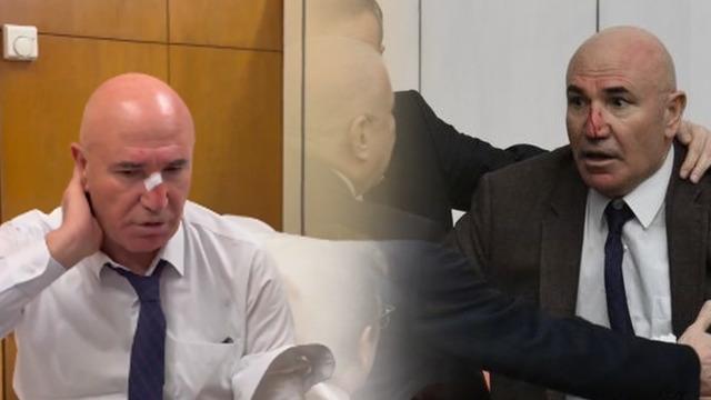 Meclis'teki yumruklu kavgada CHP'li Tanal'ın burnu kanadı! İlk müdahale revirde yapıldı