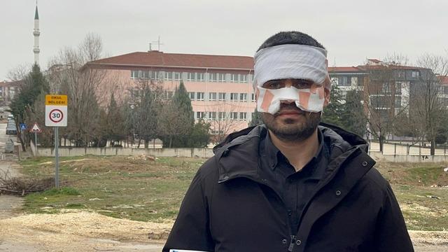 Öğretmen öğretmene bunu yapar mı? Bu kadarına pes: Kaynar çayı yüzüne fırlatıp...