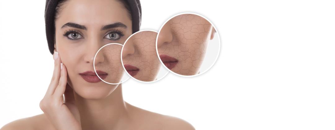 Soğuk hava cilt bariyerini zayıflatıyor! Kışın cildinizi korumanın altın kuralları 5