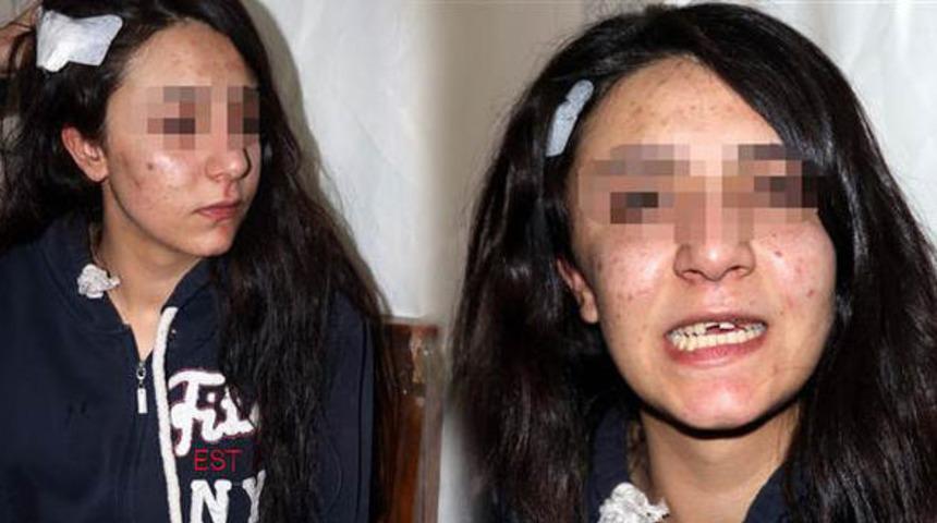 Adana'da akılalmaz olay! Dertleşme bahanesiyle çağırdı bu hale getirdi!