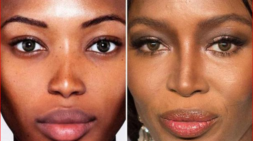 Ünlü mankene eleştiri yağıyor! 'Çok güzelsin ama burnun nerede?'