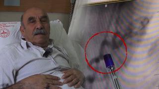 Son dakika: G&ouml;ğ&uuml;s yanması sandı, kalbinden kan '&ccedil;alan' damar bulundu!